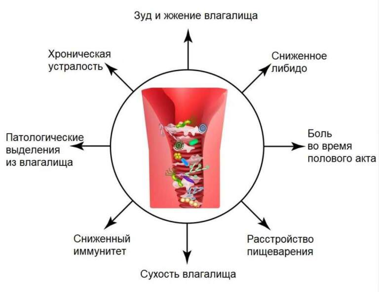 Как избавиться от кислого запаха выделений у женщины: причины и советы